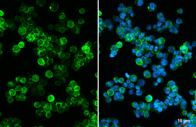 Anti-CD20 antibody [HL6217] used in Immunocytochemistry/ Immunofluorescence (ICC/IF). GTX648309